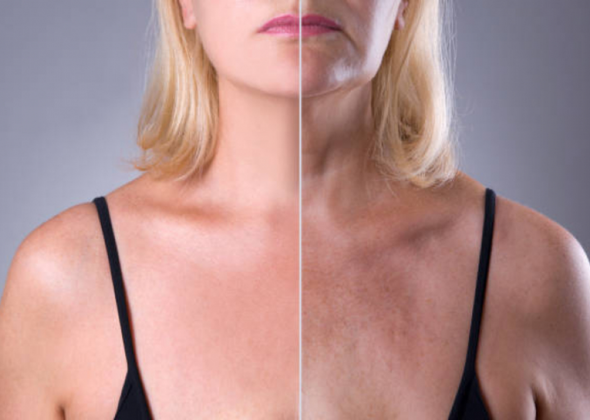 Fotona 590 x 420 f4d 04