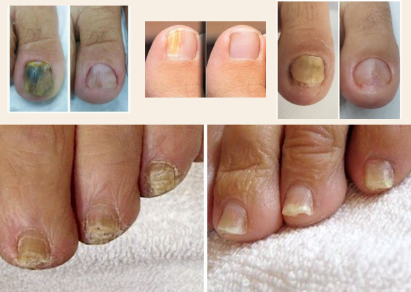 Fotona 590 x 420 f4d 06