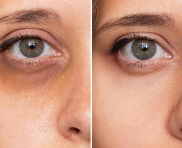 Lavieen 590 x 480 l2