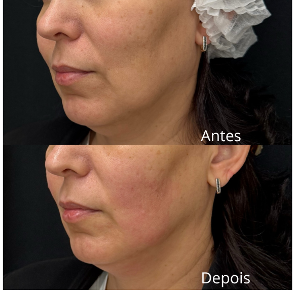 ultra 02 582 x575 ad